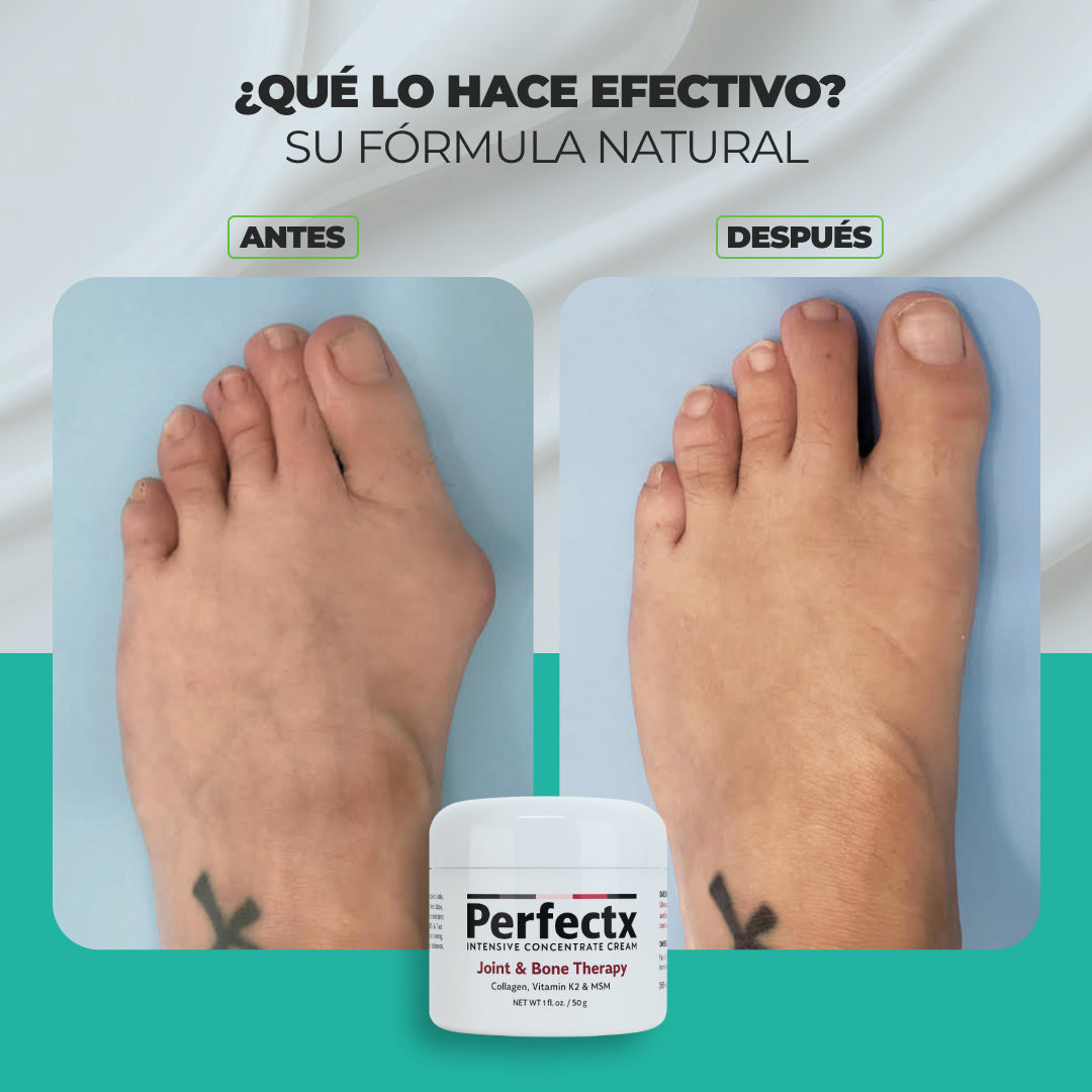 Perfectx | Terapia Articular Y Muscular